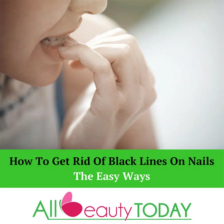 Comment se débarrasser des stries sur les ongles ?